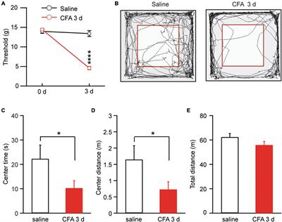 Synaptic plasticity in two cell types of central amygdala for regulation of emotion and pain